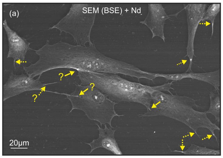 https://cdn.ncbi.nlm.nih.gov/pmc/blobs/ed59/11508255/a093cd673696/ijms-25-11076-g005a.jpg