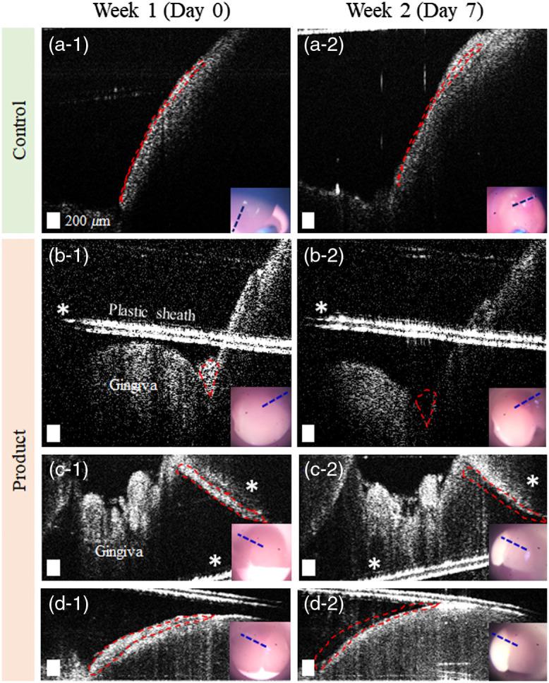 https://cdn.ncbi.nlm.nih.gov/pmc/blobs/ed5b/7690845/3841faf448e5/JBO-025-116011-g005.jpg
