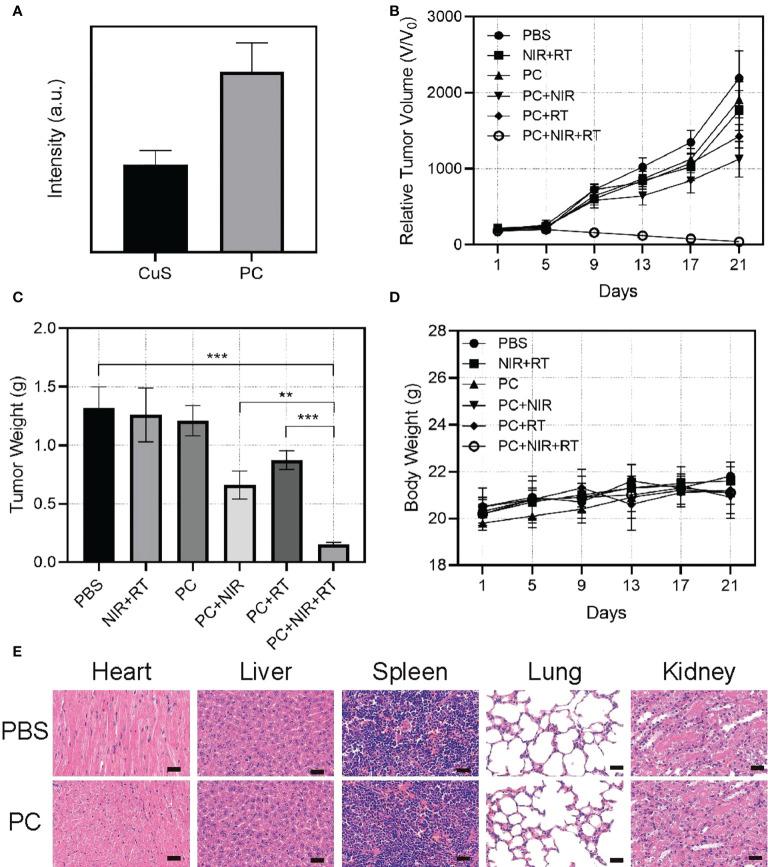 https://cdn.ncbi.nlm.nih.gov/pmc/blobs/ed5e/9730236/7ba502d50781/fonc-12-1054608-g004.jpg