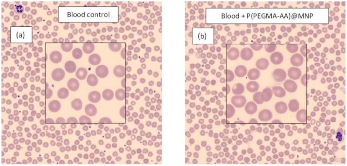 https://cdn.ncbi.nlm.nih.gov/pmc/blobs/ed61/6215243/862a794d1725/nanomaterials-08-00776-g008.jpg