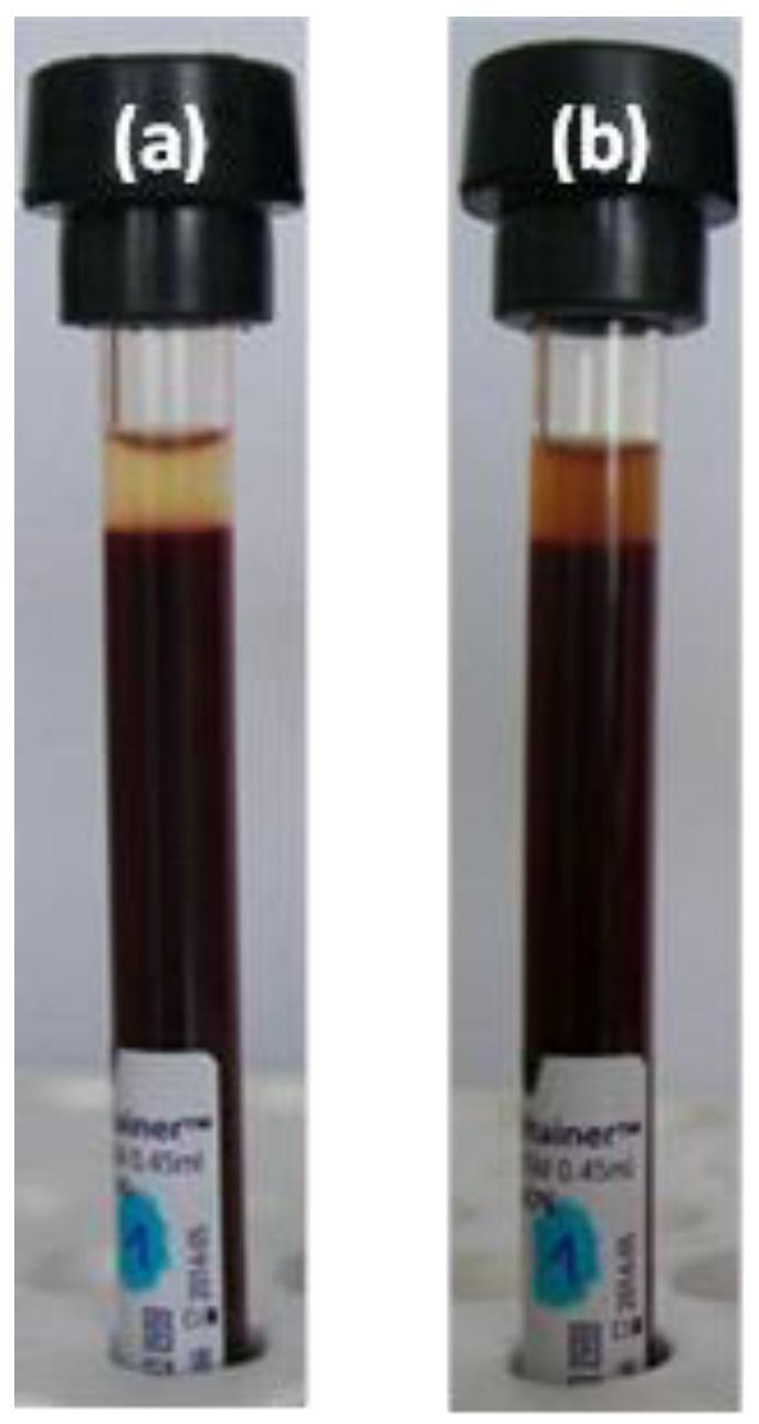 https://cdn.ncbi.nlm.nih.gov/pmc/blobs/ed61/6215243/a0cd0901429a/nanomaterials-08-00776-g007.jpg