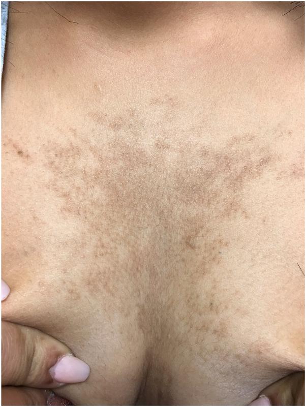 https://cdn.ncbi.nlm.nih.gov/pmc/blobs/ed69/12329474/038dca89c827/gr1.jpg