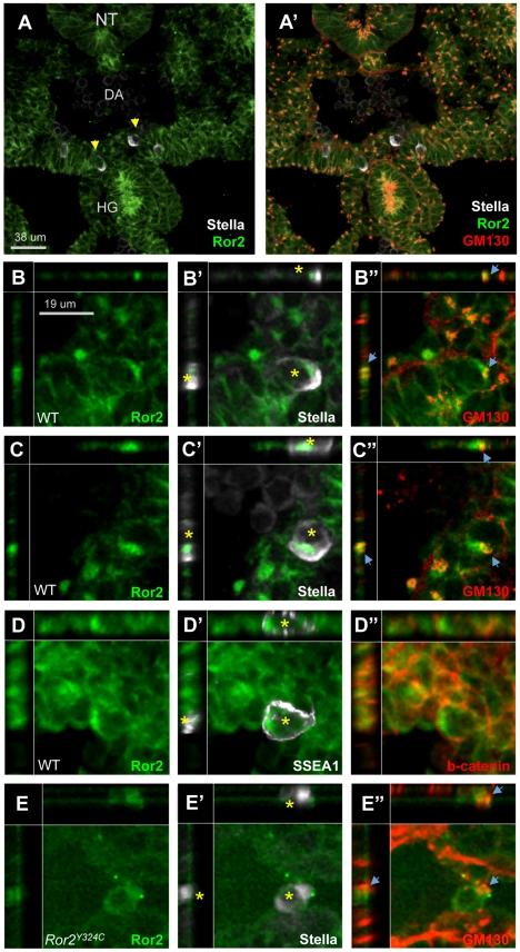 https://cdn.ncbi.nlm.nih.gov/pmc/blobs/ed69/3245308/35397f19a58e/pgen.1002428.g006.jpg