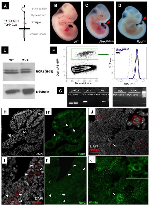 https://cdn.ncbi.nlm.nih.gov/pmc/blobs/ed69/3245308/8d6a906a4b3f/pgen.1002428.g001.jpg