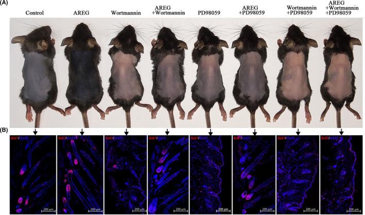 https://cdn.ncbi.nlm.nih.gov/pmc/blobs/ed69/8450126/efba102fa818/CPR-54-e13106-g007.jpg