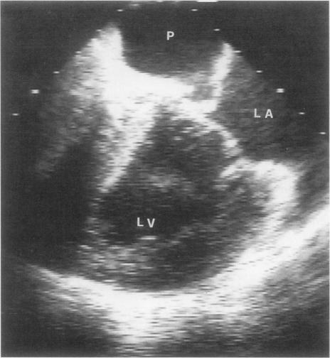 https://cdn.ncbi.nlm.nih.gov/pmc/blobs/ed6c/325673/cfc1f7b6139f/thij00019-0076-a.jpg