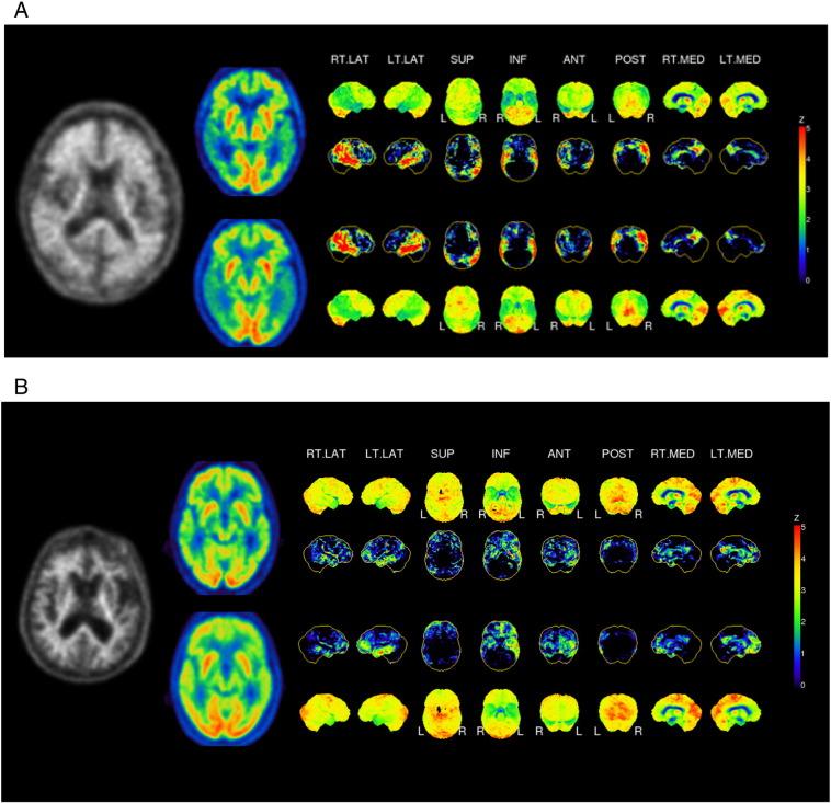 https://cdn.ncbi.nlm.nih.gov/pmc/blobs/ed6c/5257027/1c1df0a89db1/gr2.jpg