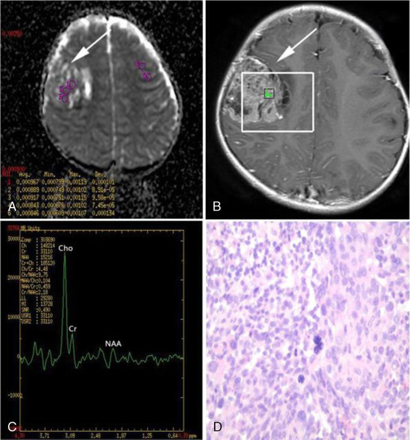 https://cdn.ncbi.nlm.nih.gov/pmc/blobs/ed70/7972297/45d482f73113/rct-45-269-g003.jpg