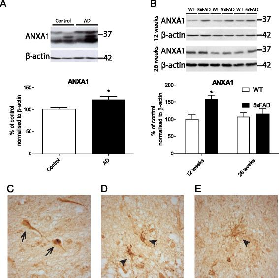 https://cdn.ncbi.nlm.nih.gov/pmc/blobs/ed71/5010757/53353075a314/12974_2016_692_Fig1_HTML.jpg