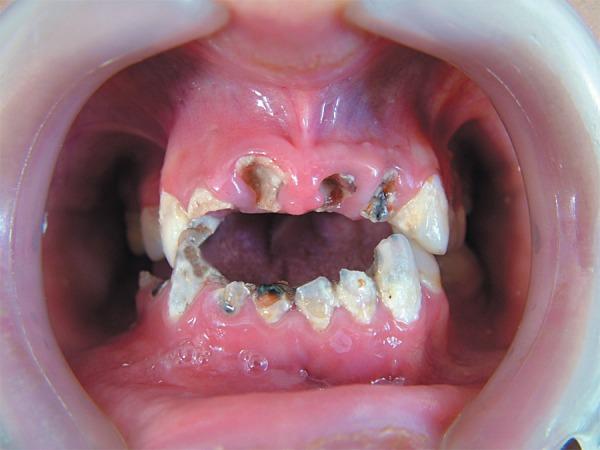 https://cdn.ncbi.nlm.nih.gov/pmc/blobs/ed72/5349758/16774107f842/jaos-18-02-0201-g01.jpg