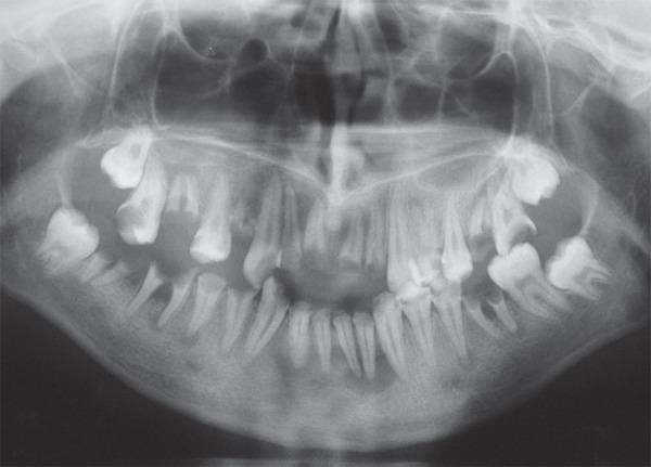https://cdn.ncbi.nlm.nih.gov/pmc/blobs/ed72/5349758/693bf4544dbc/jaos-18-02-0201-g02.jpg