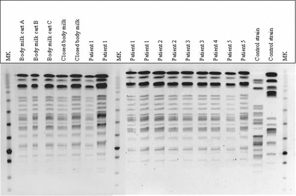 https://cdn.ncbi.nlm.nih.gov/pmc/blobs/ed7c/2374635/c22015670393/cc6778-1.jpg
