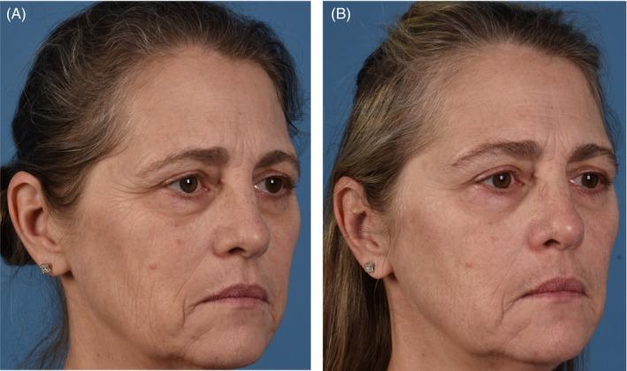 https://cdn.ncbi.nlm.nih.gov/pmc/blobs/ed82/10084046/486ea8696fa1/JOCD-22-206-g001.jpg