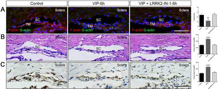 https://cdn.ncbi.nlm.nih.gov/pmc/blobs/ed85/7415318/841daa41a45c/iovs-61-6-45-f008.jpg