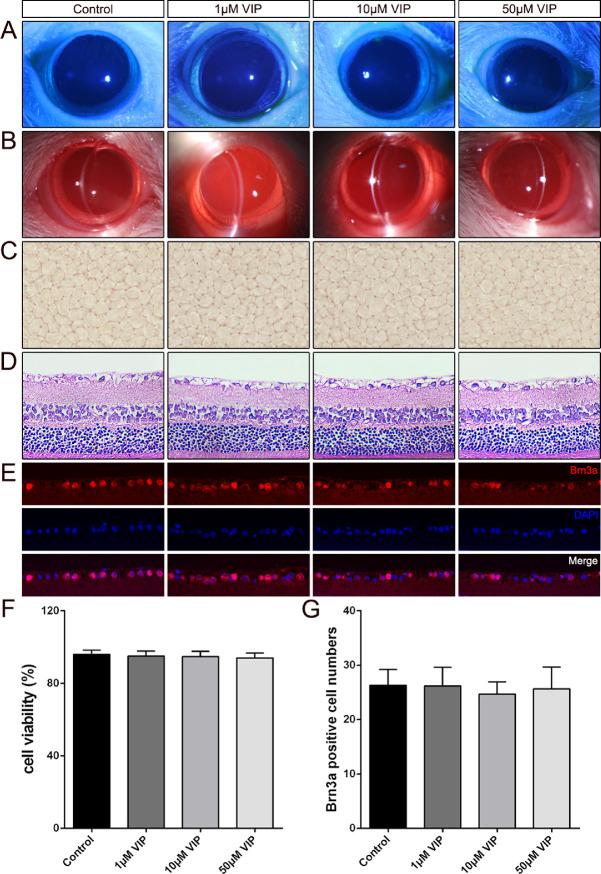 https://cdn.ncbi.nlm.nih.gov/pmc/blobs/ed85/7415318/e6eb2011f5b3/iovs-61-6-45-f003.jpg