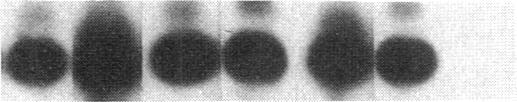 https://cdn.ncbi.nlm.nih.gov/pmc/blobs/ed86/288387/28fa8b5c8650/jcinvest00043-0025-c.jpg