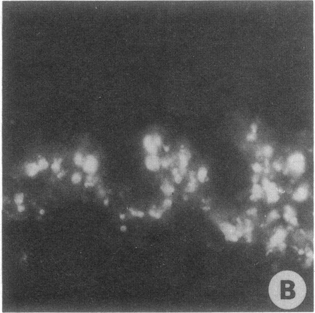 https://cdn.ncbi.nlm.nih.gov/pmc/blobs/ed86/288387/35c78ed18654/jcinvest00043-0028-a.jpg