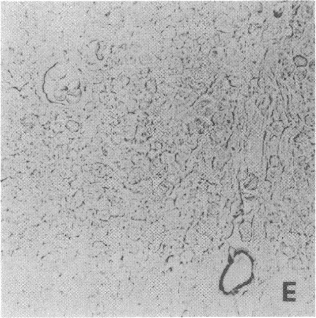 https://cdn.ncbi.nlm.nih.gov/pmc/blobs/ed86/288387/d35fba855bd5/jcinvest00043-0028-f.jpg