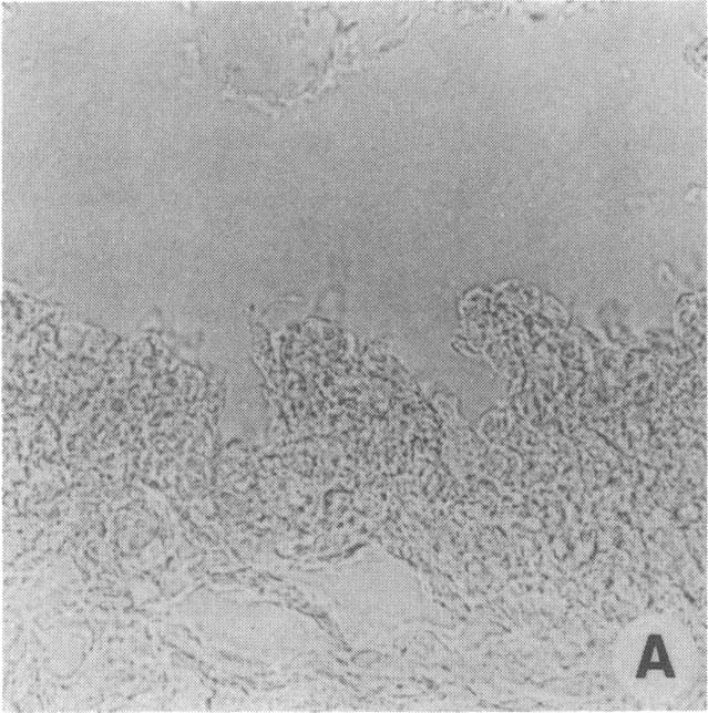 https://cdn.ncbi.nlm.nih.gov/pmc/blobs/ed86/288387/dd3c1a844d38/jcinvest00043-0028-b.jpg