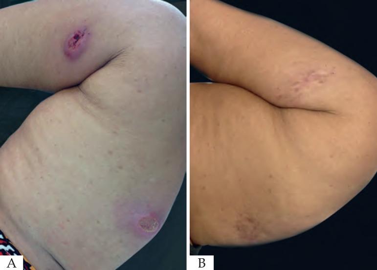 https://cdn.ncbi.nlm.nih.gov/pmc/blobs/ed86/6001097/86a0c91449ba/abd-93-03-0347-g02.jpg
