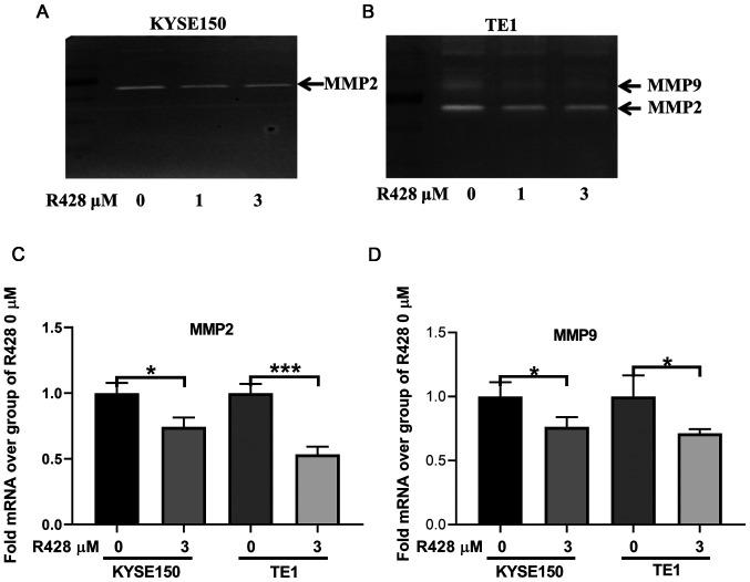 https://cdn.ncbi.nlm.nih.gov/pmc/blobs/ed86/7480165/1c3deb66e917/etm-20-05-09169-g03.jpg
