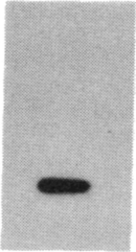 https://cdn.ncbi.nlm.nih.gov/pmc/blobs/ed8a/279511/69f1891ef896/pnas00253-0213-c.jpg