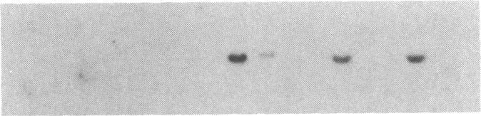 https://cdn.ncbi.nlm.nih.gov/pmc/blobs/ed8a/279511/a584e4df207f/pnas00253-0216-b.jpg