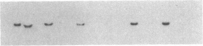 https://cdn.ncbi.nlm.nih.gov/pmc/blobs/ed8a/279511/dfec4dcfcee9/pnas00253-0216-c.jpg
