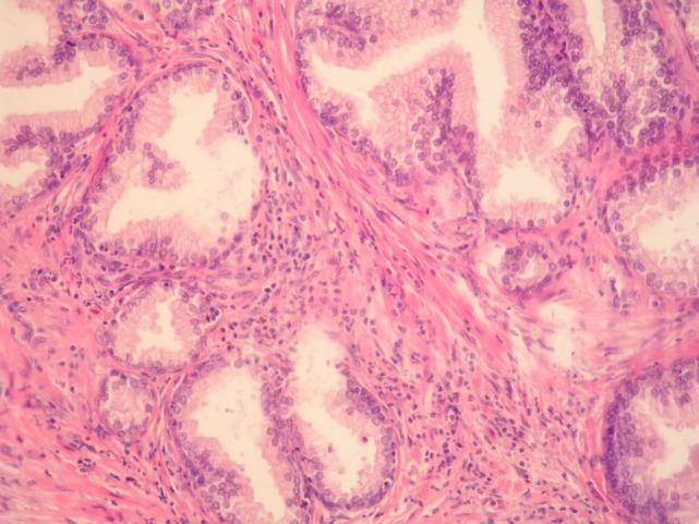 https://cdn.ncbi.nlm.nih.gov/pmc/blobs/ed92/5403898/009ff2c13cb7/fonc-07-00077-g001.jpg