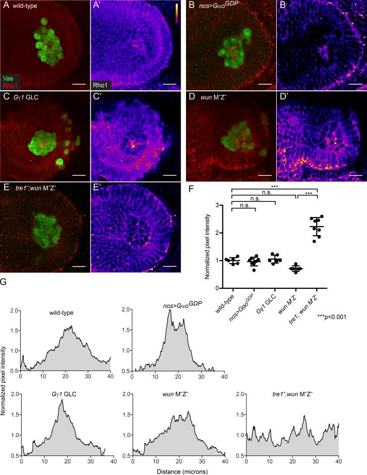 https://cdn.ncbi.nlm.nih.gov/pmc/blobs/ed95/5584160/376354fbbf15/JCB_201612053_Fig5.jpg