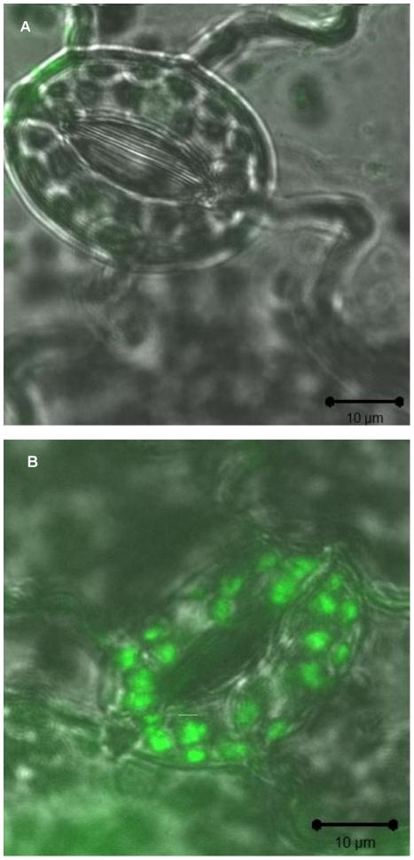 https://cdn.ncbi.nlm.nih.gov/pmc/blobs/ed9f/3082535/7a6f080f431e/pone.0018855.g004.jpg