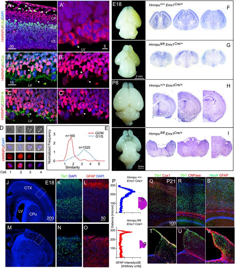 https://cdn.ncbi.nlm.nih.gov/pmc/blobs/eda0/9304408/05983e882828/41467_2022_31752_Fig1_HTML.jpg