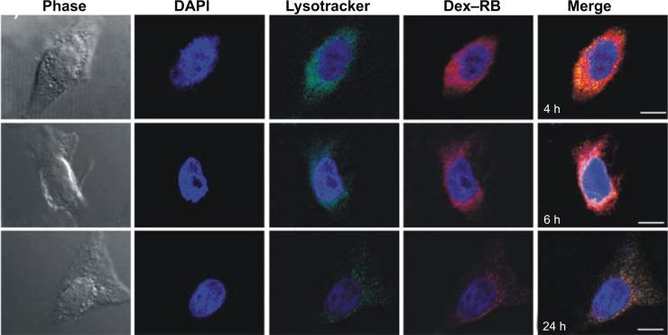 https://cdn.ncbi.nlm.nih.gov/pmc/blobs/eda3/4260688/70986a98ee9e/ijn-9-5667Fig9.jpg