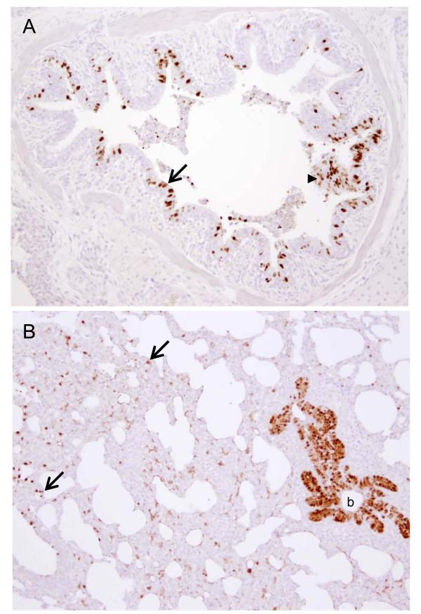 https://cdn.ncbi.nlm.nih.gov/pmc/blobs/eda4/3177912/17f609b5f507/1743-422X-8-434-5.jpg