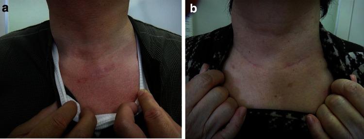 https://cdn.ncbi.nlm.nih.gov/pmc/blobs/edb2/3931932/1b67025f587e/464_2013_3245_Fig5_HTML.jpg