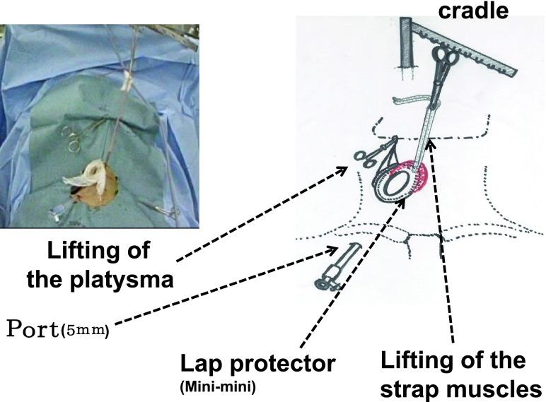 https://cdn.ncbi.nlm.nih.gov/pmc/blobs/edb2/3931932/1ca3174912c0/464_2013_3245_Fig2_HTML.jpg