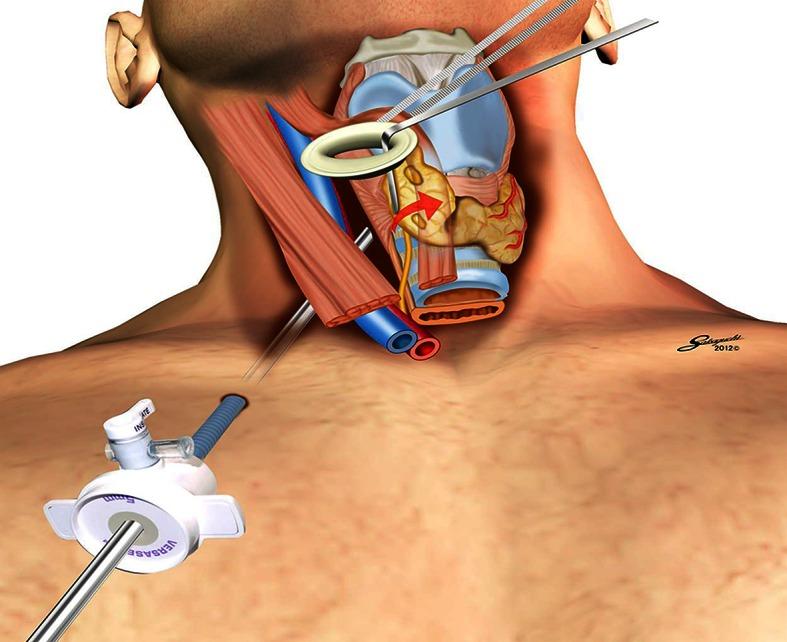 https://cdn.ncbi.nlm.nih.gov/pmc/blobs/edb2/3931932/56d6c933ee4c/464_2013_3245_Fig3_HTML.jpg
