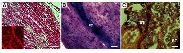 https://cdn.ncbi.nlm.nih.gov/pmc/blobs/edb3/2822826/d35f9c080363/1471-2474-11-10-4.jpg