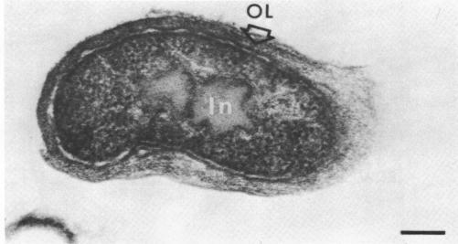 https://cdn.ncbi.nlm.nih.gov/pmc/blobs/edb7/235425/43616415c973/jbacter00302-0339-a.jpg