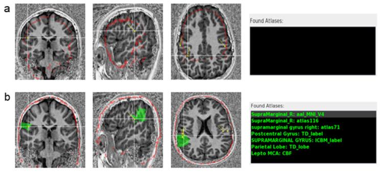 https://cdn.ncbi.nlm.nih.gov/pmc/blobs/edbe/11051542/17c1d0671a86/jimaging-10-00080-g003.jpg