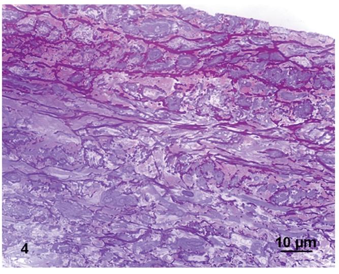 https://cdn.ncbi.nlm.nih.gov/pmc/blobs/edbe/3167311/a9241d7775fa/ejh-2010-3-e33-g004.jpg
