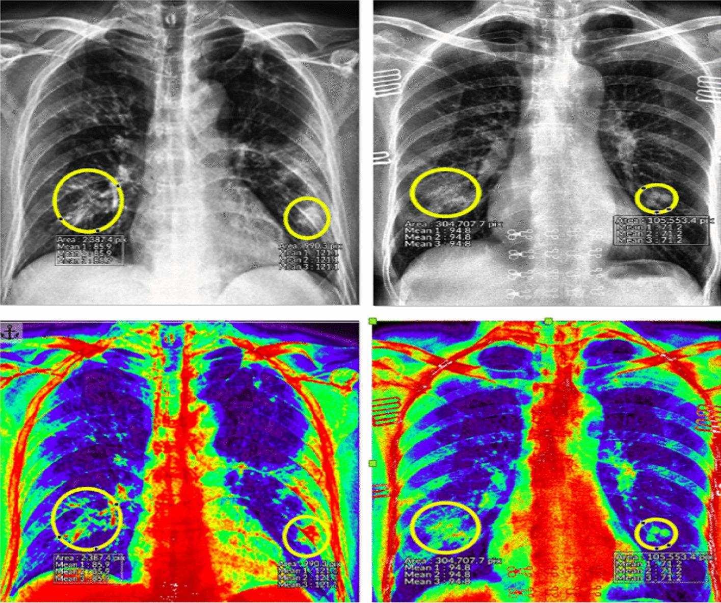 https://cdn.ncbi.nlm.nih.gov/pmc/blobs/edbf/10792799/b788431ab971/12859_2023_5427_Fig4_HTML.jpg
