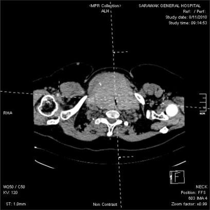 https://cdn.ncbi.nlm.nih.gov/pmc/blobs/edc0/3366316/e64d97ca46f6/kjae-62-474-g004.jpg