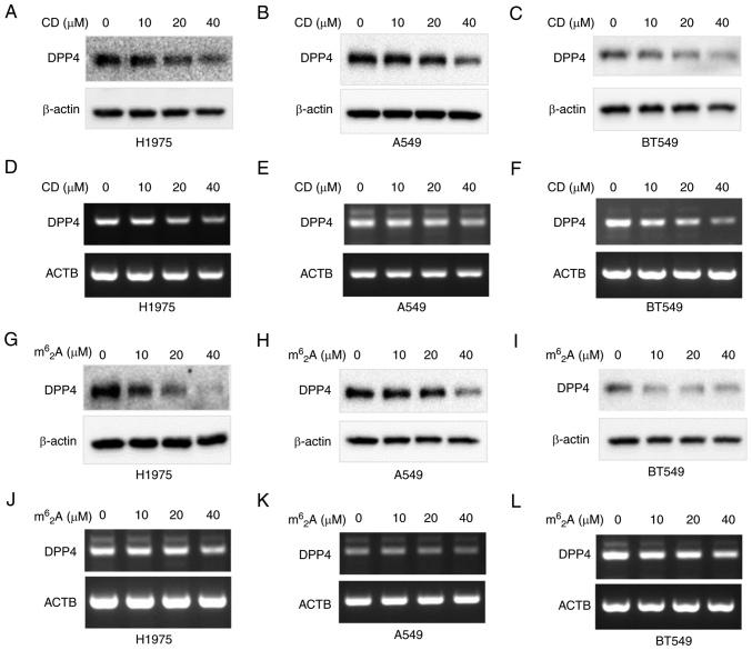 https://cdn.ncbi.nlm.nih.gov/pmc/blobs/edc2/9946808/3b71481a49f5/IJO-62-3-05489-g08.jpg
