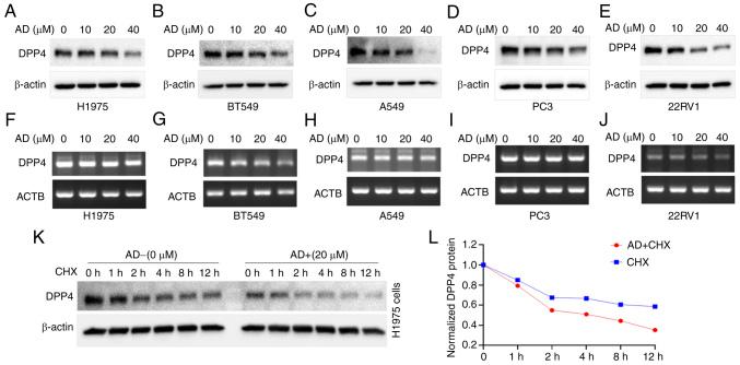 https://cdn.ncbi.nlm.nih.gov/pmc/blobs/edc2/9946808/55d95e4afa1d/IJO-62-3-05489-g09.jpg