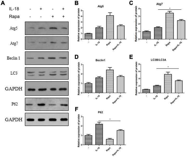 https://cdn.ncbi.nlm.nih.gov/pmc/blobs/edc7/7138594/1fd35e986e7e/aging-12-102937-g004.jpg