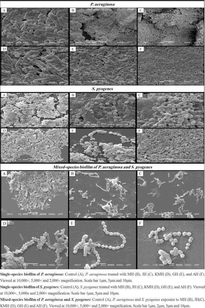 https://cdn.ncbi.nlm.nih.gov/pmc/blobs/edca/9168249/4da1ea194e47/IJM-14-238-g003.jpg