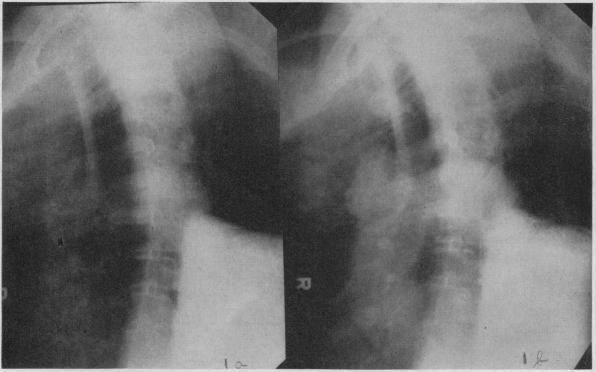 https://cdn.ncbi.nlm.nih.gov/pmc/blobs/edcb/1532069/0f0b364f9376/califmed00291-0022-a.jpg