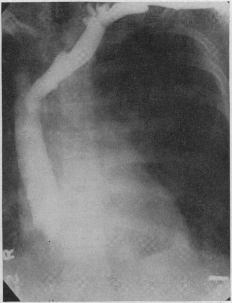 https://cdn.ncbi.nlm.nih.gov/pmc/blobs/edcb/1532069/baf5e8422baa/califmed00291-0021-b.jpg