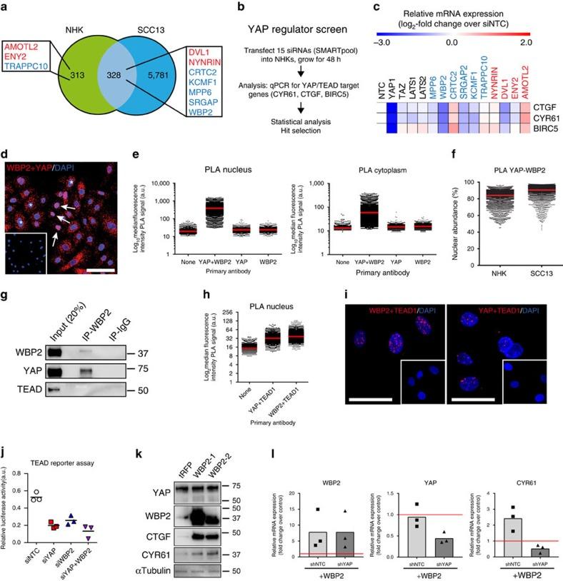 https://cdn.ncbi.nlm.nih.gov/pmc/blobs/edcd/5376649/ab96f8ff6bb1/ncomms14744-f2.jpg